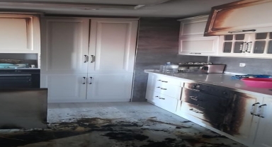 Amasya’da çıkan ev yangınında yaralanan kişi hastaneye kaldırıldı